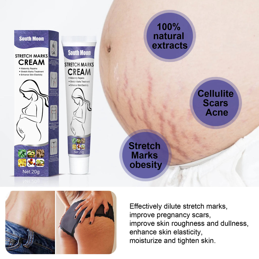 Pregnancy Stretch Marks Removal Cream - Skin Care - Babymate